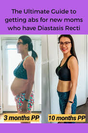 Best exercises for diastasis recti. This Is A Before And After Picture When I Was 3 Months And 10months Postpartum With My Second Child In This Post Diastasis Diastasis Recti Post Partum Workout
