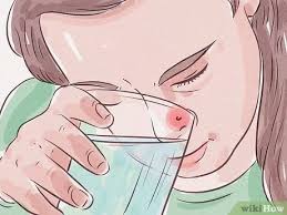 3 Ways To Treat An Infected Nose Piercing Wikihow