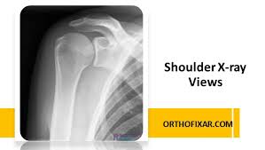 Image result for Shoulder Imaging