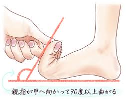 自分でできる浮き指の改善方法５つ！放置すると腰痛や肩こりの原因に｜病気スコープ