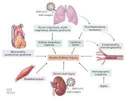 Maybe you would like to learn more about one of these? Covid 19 And The Kidney Cleveland Clinic Journal Of Medicine