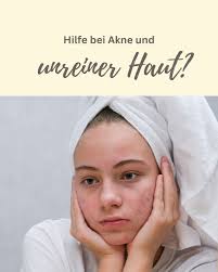 Dr. Christina Hauser ist Ihre Expertin bei Akne. Wir beraten Sie gerne! ☺️