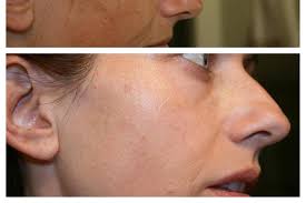 Rodan & Fields, Dermatologists