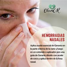 Las Hemorragias Nasales Pueden Ser Causadas Por Irritaciones Debido A Alergias Resfriados Estornud Aceite Esencial De Geranio Hemorragias Nasales Hemorragia