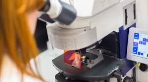 The earliest stage pancreas cancers are stage 0 (carcinoma in situ), and then range from stages i (1) through iv (4). What Are The Different Stages Of Cancer Prof Andreas Obermair Professor Andreas Obermair