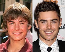 But the most surprising thing about the image is that we. Zac Efron Before And After 2020