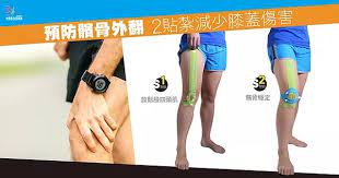 預防髕骨外翻2貼紮減少膝蓋傷害 kinesiologytaping exercise