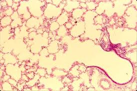 Siu Som Histology Crr