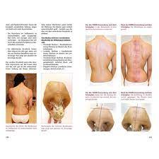 Gua sha is a technique used in traditional east asian medicine that is often used to treat muscle gua sha is the practice of using a tool to apply pressure and scrape the skin to relieve pain and tension. Buch Der Einfache Weg Zum Schropfen Guasha Massagestudio Gaisbauer