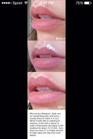 Use this for white bumps that are formed on the upper lip after waxing to prevent them from flaring up. Remove A Pimple Next To Lip Less Than 20 Minutes Beauty Remedies Beauty Hacks Health And Beauty