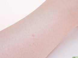 Single choice test finde das haar in der suppe. Eingewachsene Haare An Den Beinen Verhindern Mit Bildern Wikihow