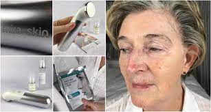 A delicate, easily absorbed gel serum with high content of popular hyaluronic acid that provides the skin with intensive hydration and gradual for enhanced hydration it is recommended to treat the skin after absorbing the serum with a tonic, whereby water will bind to the hyaluronic acid molecules. Before After Hyaluronic Acid With Mira Skin Ultrasound