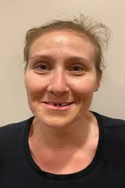 San Antonio Dental Implants