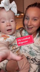 Meet Lily: Our Beautiful 9-Month-Old Girl with BPES