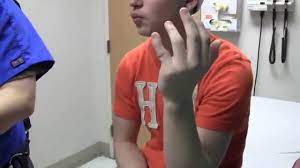 It was rather neat as the finger bent nearly 90 degrees to the side. Finger Dislocation Metacarpal Block Youtube