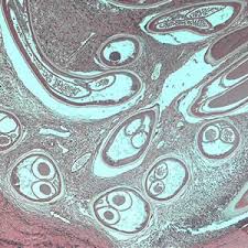 Image result for Oncocalyx bolusii