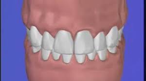 Maybe you would like to learn more about one of these? Munnhygiene Tannlege Erik Svendsrud Oslo