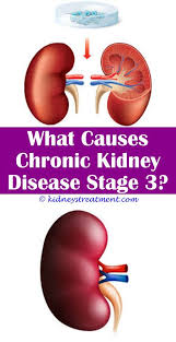 Kidney Stones Images Chronic Kidney Disease Kidney Disease Recipes Treatment For Kidney Disease