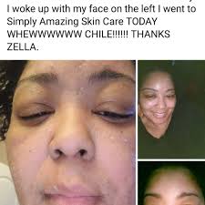 TOP 10 BEST Acne in Newport News, VA