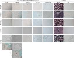 This reduces the risk of market timing and can potentially lower your. Bcip Nbt Staining Of Paraffin Sections From Various Organs Of Download Scientific Diagram
