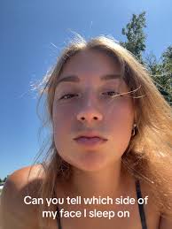 How Long Does It Take for Your Wisdom Teeth Holes to Fully Close