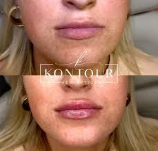 This is for the women in this group! Ladies can anyone recommend a safe ,  very reliable and experienced place for injectables ( Botox