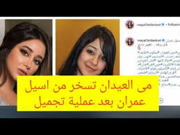 ‎ لأ عقارب الساعه بتقف بعد شخص معين ، والحياة ساعتها بتشد خط ما بين قبل وبعد صحيح إنت هتفضل عايش ، بس جسد م.ن غير روح ، ايامك بطيئة ومُمله ، قدرتك على الإحساس بتقِل تدريجياً ، في حته جواك. Ù…Ù‰ Ø§Ù„Ø¹ÙŠØ¯Ø§Ù† ØªØ³Ø®Ø± Ù…Ù† Ø§Ù†Ù Ø§Ø³ÙŠÙ„ Ø¹Ù…Ø±Ø§Ù† Ø¨Ø¹Ø¯ Ø¹Ù…Ù„ÙŠØ© ØªØ¬Ù…ÙŠÙ„ ÙØ§Ø´Ù„Ø© Youtube