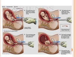Bacterial infections are the most common cause, but other types of infections can also cause it. Sepsis Opredelenie Etiologiya Patogenez Klassifikaciya Diagnostika Lechenie Prezentaciya Onlajn
