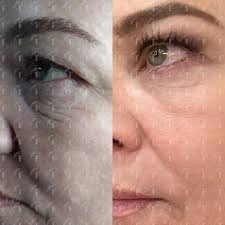 Felavi Center Opiniones