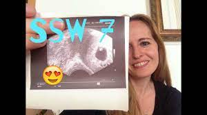 Ssw 7 Update Ultraschall Schwangerschaftswoche 7 Vlog 5 Youtube