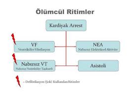 Nabızsız ventriküler taşikardi ekg örneği. Interaktif Sozluk