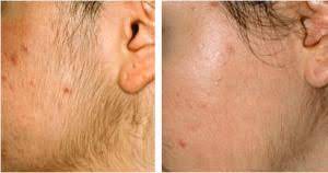 Pin On Health Beauty