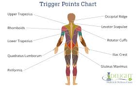 Have back pain on one side only? Trigger Points And Referral Pain Delight Medical And Wellness Center