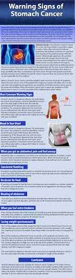 They can affect your digestion, such as: Digestive Cancers