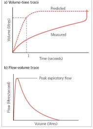 Interpretation And Evaluation Of Pulmonary Function Tests