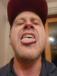 Device failed to treat sleep apnea