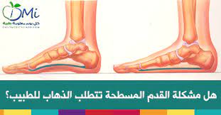 القدم المسطحة فلات فوت ما أسباب حدوث القدم المسطحة ومتى يجب غليك الذهاب إلي الطبيب health