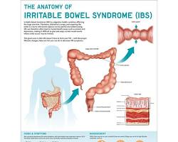 Image of IBS anatomy diagram