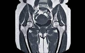 Con la tc si possono vedere dettagli al millimetro. Risonanza Magnetica Bacino Medical Imaging Caserta