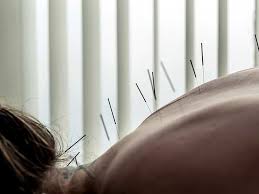 Jan 18, 2021 · typical steps to become an acupuncturist: Acupuncture How It Works Benefits And Results For Pain