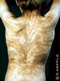 Humans Have Invisible Stripes That Are Sometimes Visible To Other Huma... |  Bioluminescent Human | Tiktok