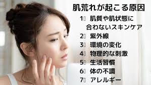 肌荒れが起こる原因は 肌 スキンケア 肌荒れ
