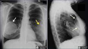 Pin On Excalibur Healthcare S Imaging Teleradiology Pins