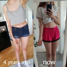 It took me very long but I can finally say that I love my body and that I  beat anorexias ass. I moved on from toxic people and poor mental and pretty