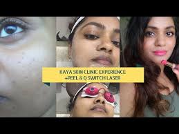 We have created laser hair removal specials and great offers at low prices because everyone should have the opportunity to experience the benefits of looking their best with the. My Skin Peeling Laser Treatment Experience From Kaya Skin Clinic India Youtube