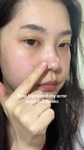 Revitalize Your Skin with Sadoer Vitamin C Toner