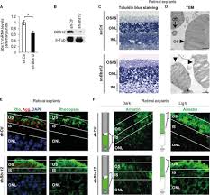 Die beliebtesten wincent weiss logo ww verglichen 06/2021 🐷 erfahrungen echter kunden testberichte zu wincent weiss logo ww analysiert. Pharmacological Modulation Of The Retinal Unfolded Protein Response In Bardet Biedl Syndrome Reduces Apoptosis And Preserves Light Detection Ability Journal Of Biological Chemistry