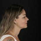 Dra Taíse Simonetti &amp; Dr Bruno Trevisan