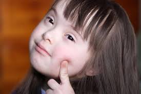 El síndrome de down es la más común y fácil de reconocer de todas las condiciones asociadas con la discapacidad intelectual. Uptodate Sindrome De Down Gestion Red Latinoamericana De Pediatria Y Neonatologia