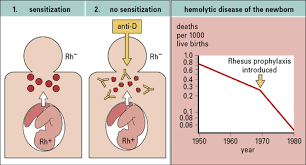 Image result for Rh Sensitization